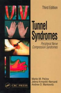 Cover image for Tunnel Syndromes