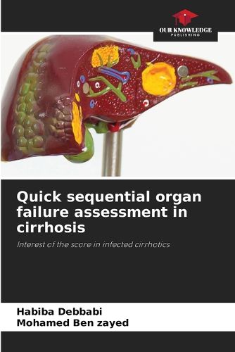 Cover image for Quick sequential organ failure assessment in cirrhosis