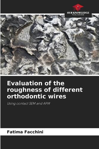 Cover image for Evaluation of the roughness of different orthodontic wires