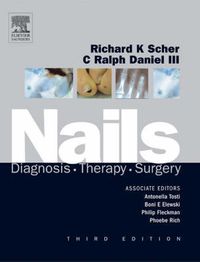 Cover image for Nails: Diagnosis, Therapy, Surgery