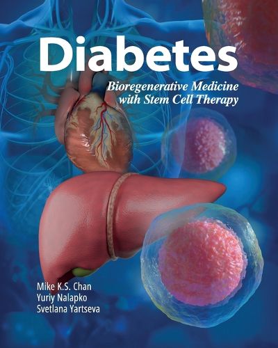 Cover image for Diabetes