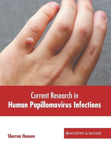 Cover image for Current Research in Human Papillomavirus Infections