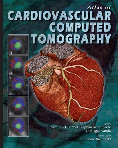 Cover image for Atlas of Cardiovascular Computed Tomography