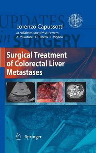 Cover image for Surgical Treatment of Colorectal Liver Metastases