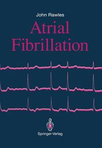 Cover image for Atrial Fibrillation