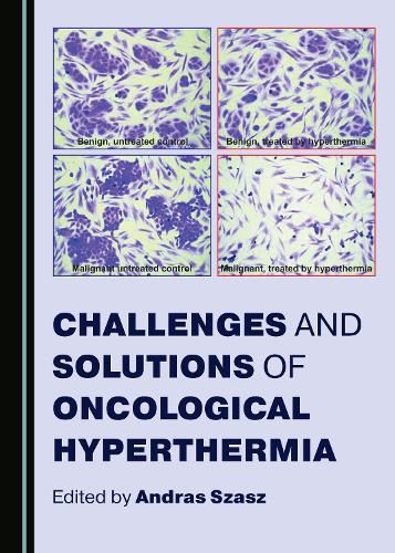 Cover image for Challenges and Solutions of Oncological Hyperthermia