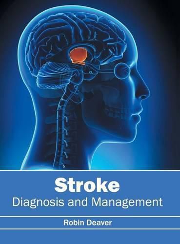 Cover image for Stroke: Diagnosis and Management