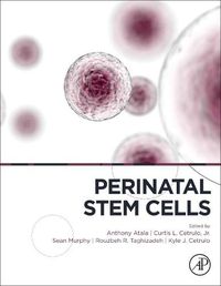 Cover image for Perinatal Stem Cells: Research and Therapy