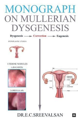 Cover image for Monograph on Mullerian Dysgenesis