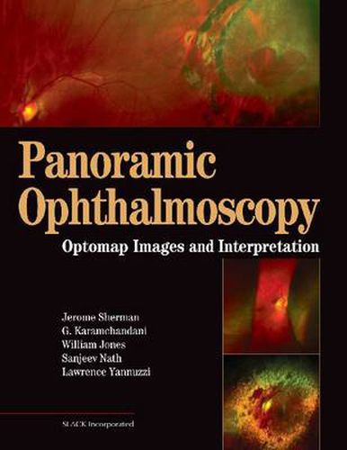 Panoramic Ophthalmoscopy: Optomap Images and Interpretation