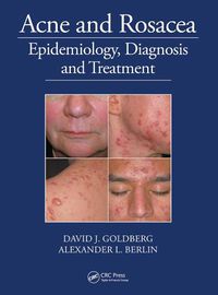 Cover image for Acne and Rosacea: Epidemiology, Diagnosis and Treatment