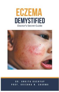 Cover image for Eczema Demystified