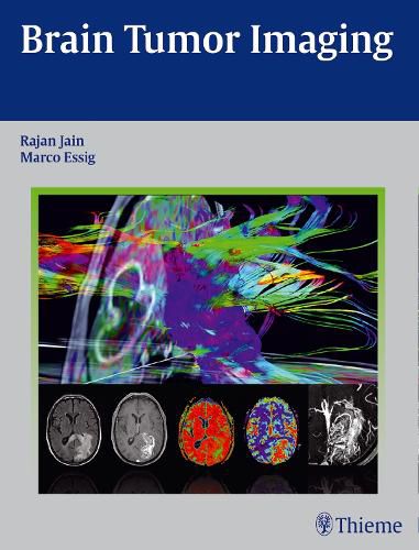 Cover image for Brain Tumor Imaging