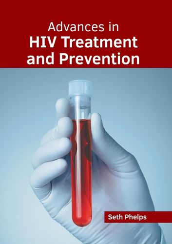 Cover image for Advances in HIV Treatment and Prevention