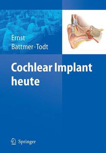 Cover image for Cochlear Implant Heute