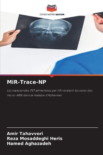 Cover image for MiR-Trace-NP