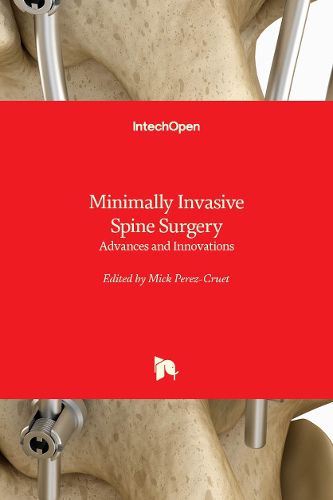 Cover image for Minimally Invasive Spine Surgery