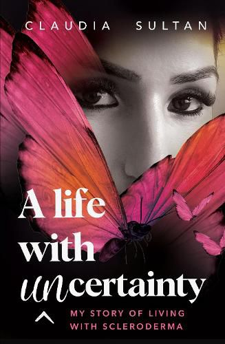 A Life With Uncertainty: My story of living with Scleroderma