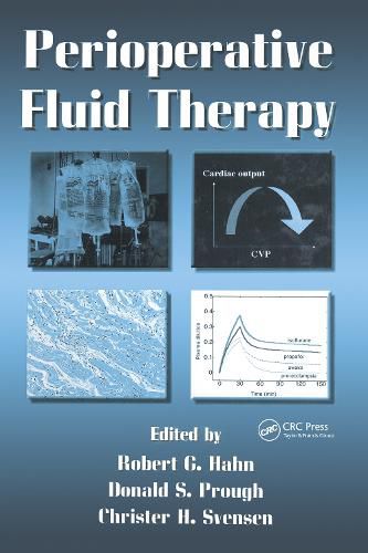 Cover image for Perioperative Fluid Therapy