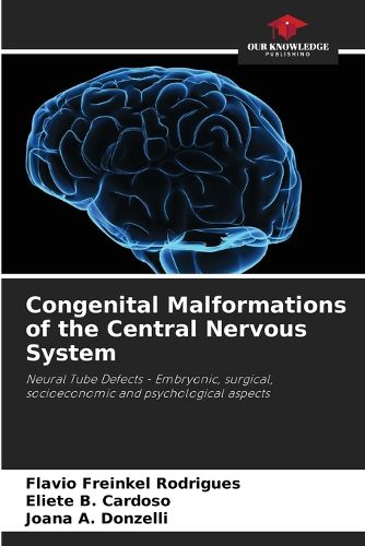 Cover image for Congenital Malformations of the Central Nervous System