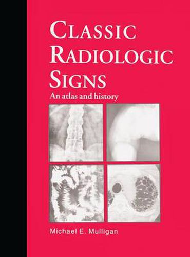 Cover image for Classic Radiologic Signs: An Atlas and History