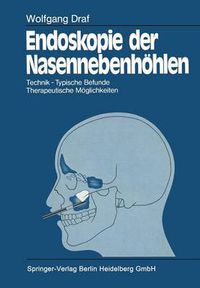 Cover image for Endoskopie der Nasennebenhoehlen: Technik * Typische Befunde, Therapeutische Moeglichkeiten