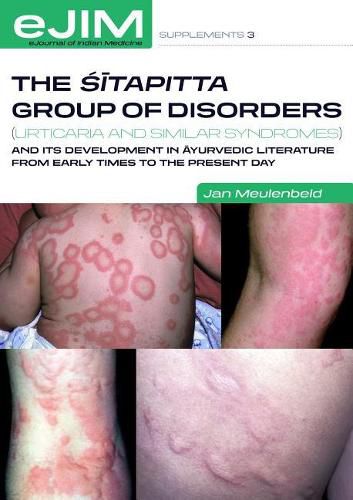Cover image for The Sitapitta group of disorders (urticaria and similar syndromes) and its development in ayurvedic literature from early times to the present day