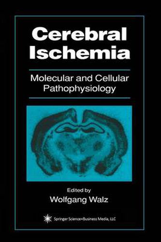 Cover image for Cerebral Ischemia: Molecular and Cellular Pathophysiology