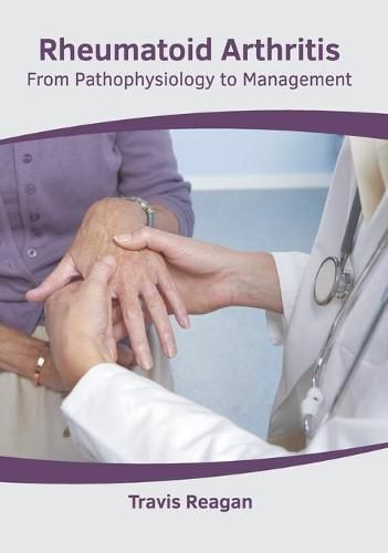 Cover image for Rheumatoid Arthritis: From Pathophysiology to Management