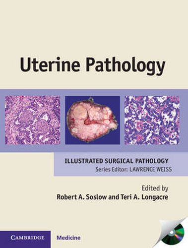 Cover image for Uterine Pathology