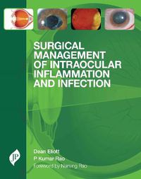 Cover image for Surgical Management of Intraocular Inflammation and Infection