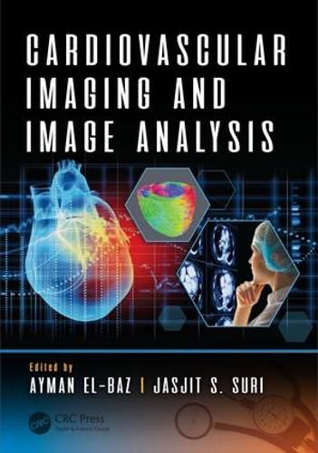 Cover image for Cardiovascular Imaging and Image Analysis