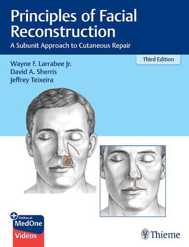 Cover image for Principles of Facial Reconstruction: A Subunit Approach to Cutaneous Repair
