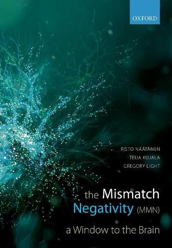 Cover image for Mismatch Negativity: A Window to the Brain