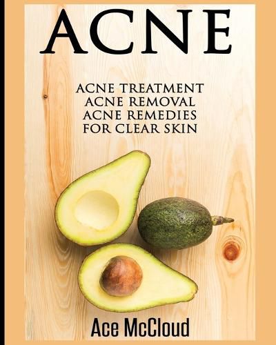 Cover image for Acne: Acne Treatment: Acne Removal: Acne Remedies For Clear Skin