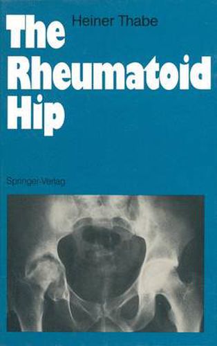 Cover image for The Rheumatoid Hip