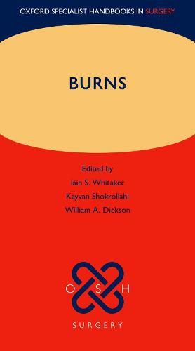 Cover image for Burns