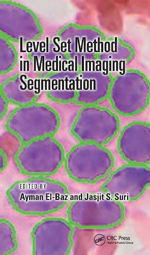 Cover image for Level Set Method in Medical Imaging Segmentation