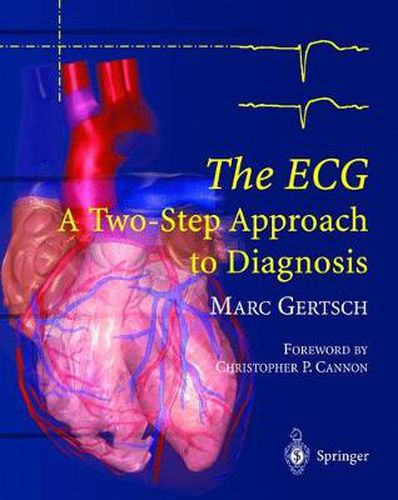 The ECG: A Two-Step Approach to Diagnosis