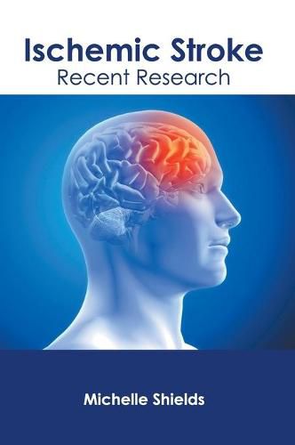 Cover image for Ischemic Stroke: Recent Research