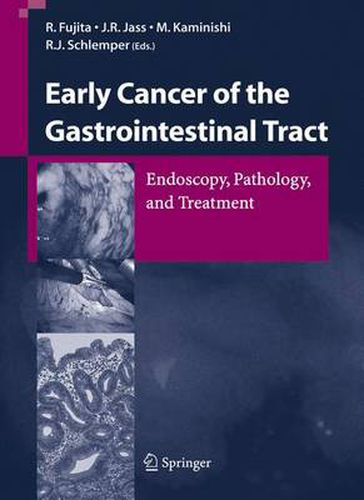 Cover image for Early Cancer of the Gastrointestinal Tract: Endoscopy, Pathology, and Treatment
