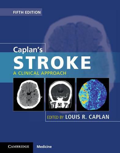 Cover image for Caplan's Stroke: A Clinical Approach