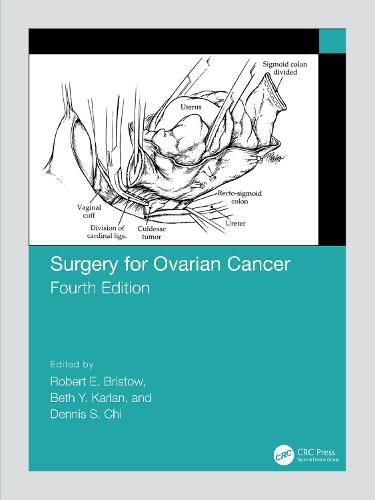 Cover image for Surgery for Ovarian Cancer