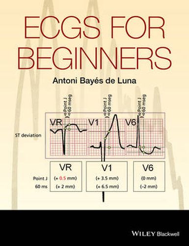 Cover image for ECGs for Beginners