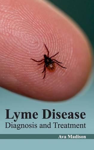 Cover image for Lyme Disease: Diagnosis and Treatment