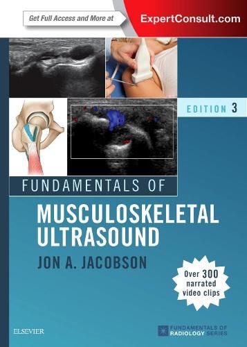 Cover image for Fundamentals of Musculoskeletal Ultrasound