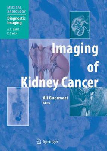 Cover image for Imaging of Kidney Cancer