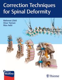 Cover image for Correction Techniques for Spinal Deformity