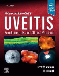 Cover image for Whitcup and Nussenblatt's Uveitis: Fundamentals and Clinical Practice
