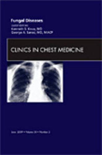 Cover image for Fungal Disease, An Issue of Clinics in Chest Medicine